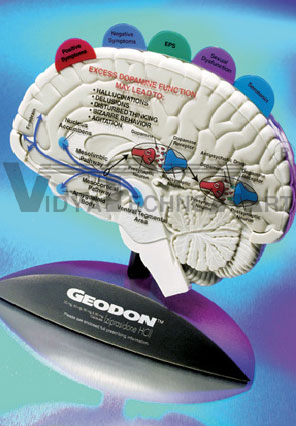 Brain Model with Tabbed Overlays